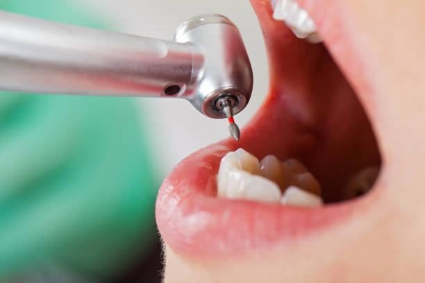 Best Emergency Dental Care for Abscessed Tooth in Rocky Point, NC